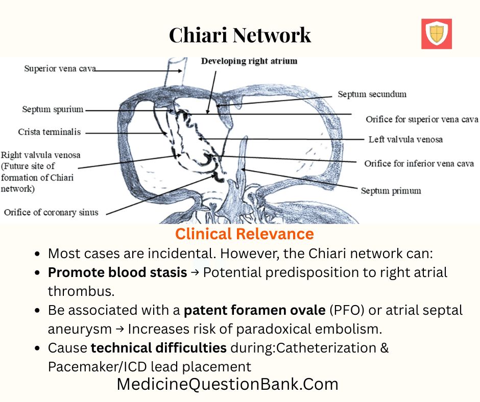 Chiari network