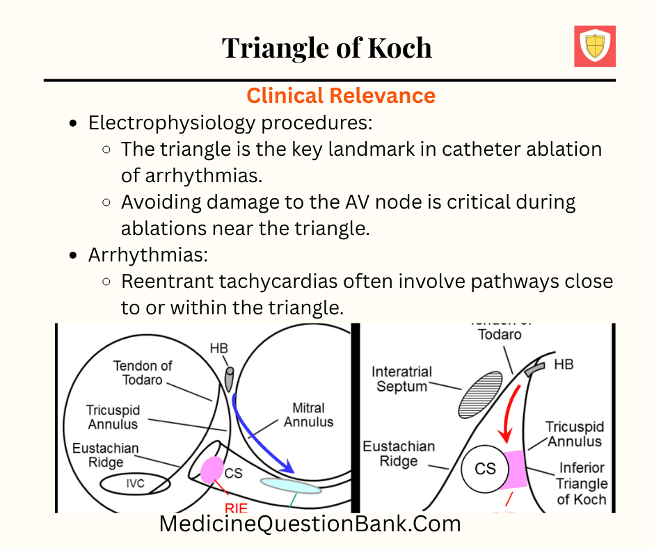 Triangle of Koch