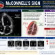 McConnell's Sign Echocardiography Guide